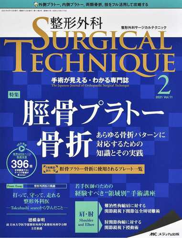 整形外科ｓｕｒｇｉｃａｌ ｔｅｃｈｎｉｑｕｅ 手術が見える わかる専門誌 第１１巻２号 ２０２１ ２ 脛骨プラトー骨折の通販 紙の本 Honto本の通販ストア