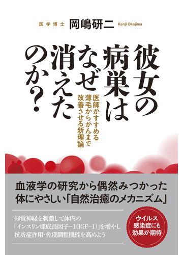 彼女の病巣はなぜ消えたのか 医師がすすめる薄毛からがんまで改善させる新理論の通販 岡嶋 研二 紙の本 Honto本の通販ストア