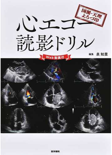 心エコー読影ドリル 国循 天理よろづ印の通販 泉 知里 紙の本 Honto本の通販ストア