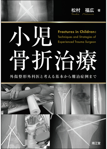 お歳暮 単行本 松村福広 小児骨折治療 外傷整形外科医と考える基本から難治症例まで 送料無料 短納期対応 Gdpcambodia Org