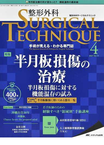 整形外科ｓｕｒｇｉｃａｌ ｔｅｃｈｎｉｑｕｅ 手術が見える わかる専門誌 第１１巻４号 ２０２１ ４ 半月板損傷の治療の通販 紙の本 Honto本の通販ストア