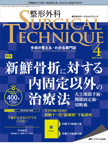 整形外科SURGICAL TECHNIQUE 手術が見える・わかる専門誌 第12巻4号（2022−4） 新鮮骨折に対する内固定以外の治療法の ...