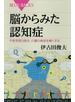 脳からみた認知症　不安を取り除き、介護の負担を軽くする